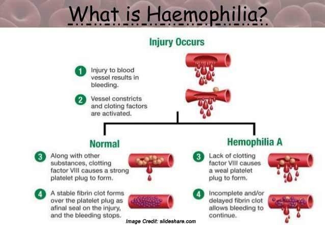 Hemophilia is a genetic blood disorder that is caused by a defective protein in the-example-1