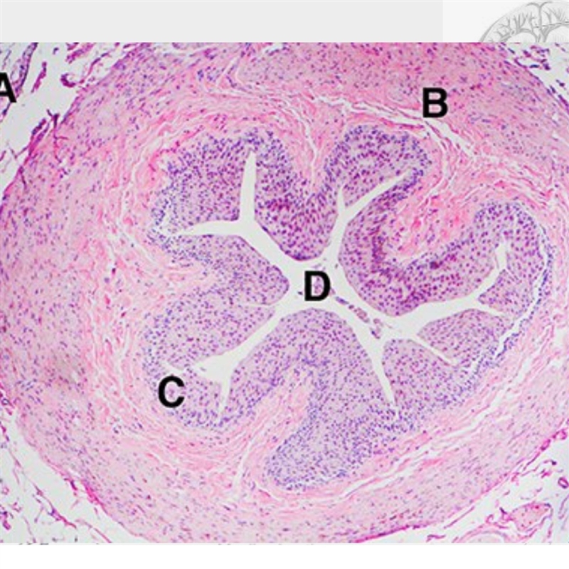 Pick the letter that indicates the tissue that contracts to drain urine to the bladder-example-1