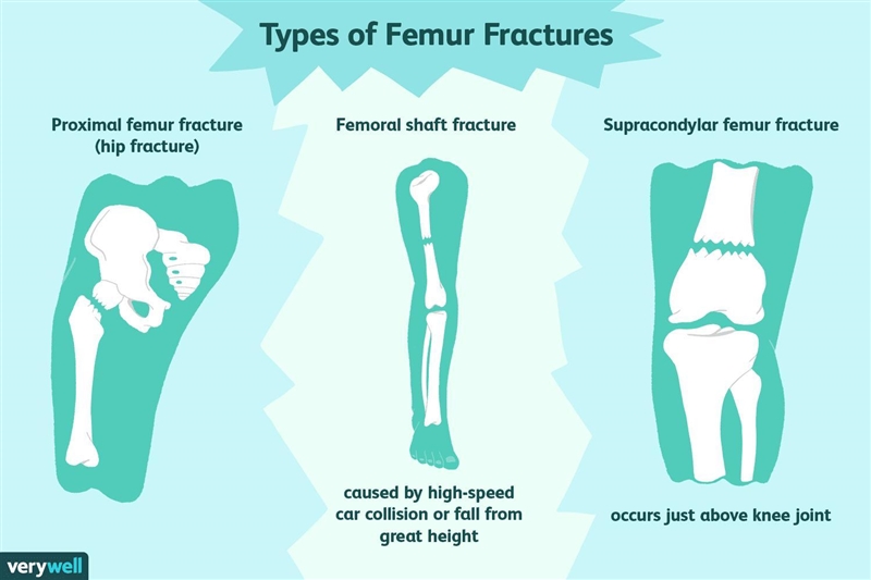 How does the shape of the treated femur compared with that of the untreated femur-example-3