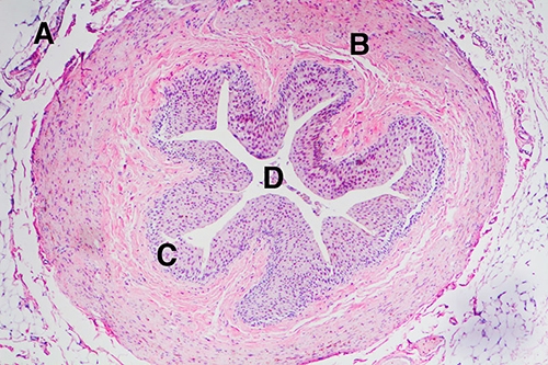 30 POINTS!!!!!!!!! Pick the letter that indicates the tissue that contracts to drain-example-1