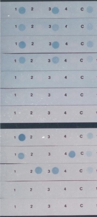 DNA fingerprinting is a laboratory technique used to establish a link between biological-example-1