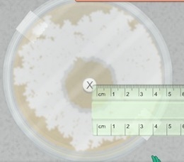 1. What is the Zone of Inhibition in this image:-example-1
