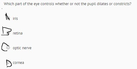 Which part of the eye controls whether or not the pupil dilates or constricts?-example-1