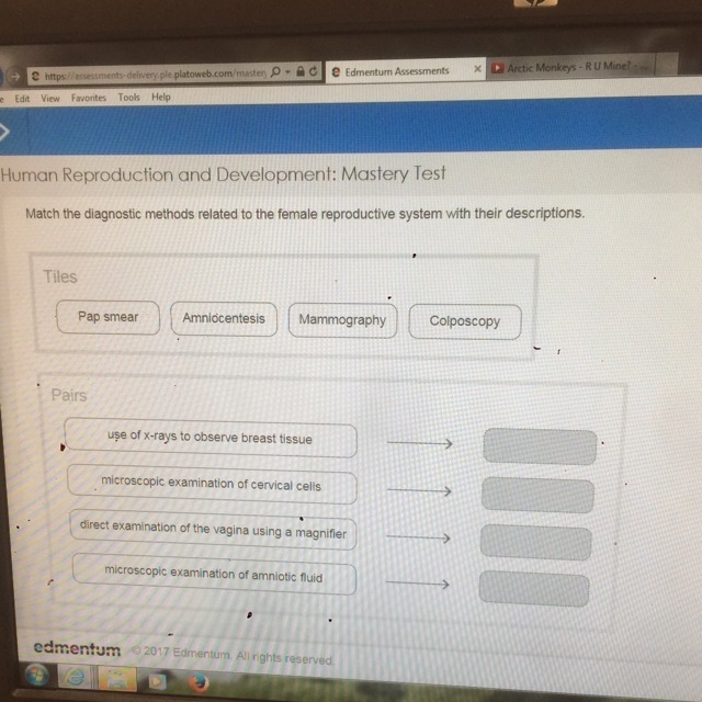 Match the diagnostic methods related to the female reproductive system with their-example-1