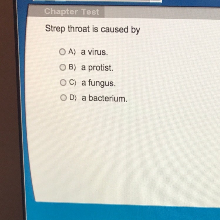 Strep throat is caused by?-example-1