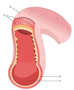 25 POINTS@!!!!!!!! Intestinal surgery is somewhat risky, as handling the intestines-example-1