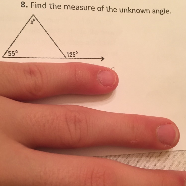 Find the measure of the unknown angle-example-1