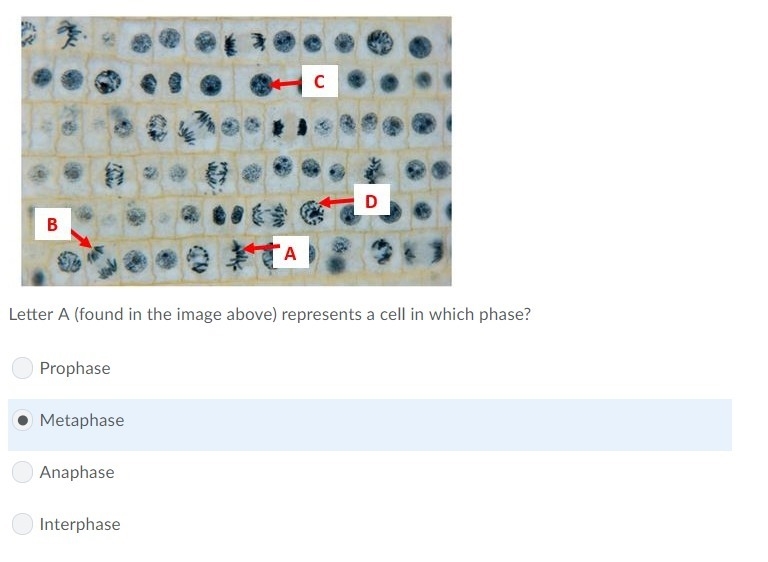 Letter A (found in the image above) represents a cell in which phase? A) Prophase-example-1