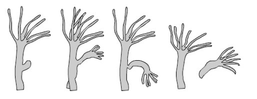 The picture shows the process of asexual reproduction in hydra. According to the illustration-example-1