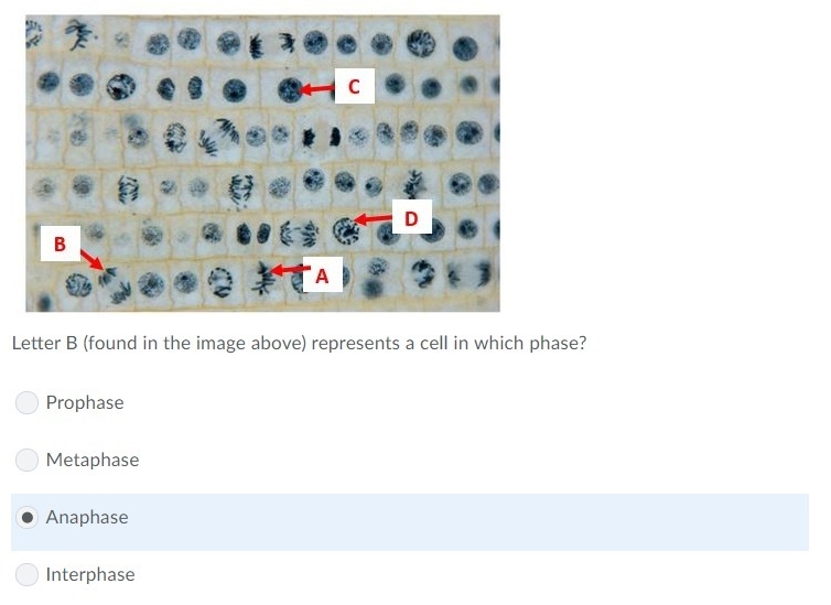 Letter B (found in the image above) represents a cell in which phase? A) Prophase-example-1