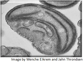 What is shown in the image? A. prokaryote B. eukaryote C. chloroplast D. mitochondrion-example-1