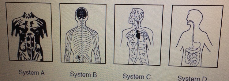 The diagrams represent some of the systems that make up the body. A similarity between-example-1