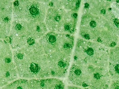 The image shows a magnified view of a leaf's surface with the stomata visible. What-example-1