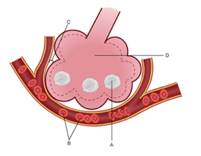 1. Based on the image above of an alveolus, in which direction will carbon dioxide-example-1