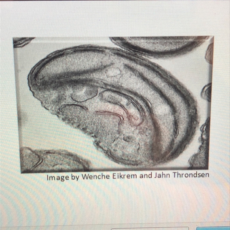 What is shown in the image A. Prokaryote B. Eukayote C. Chloroplast D. Mitochondrion-example-1