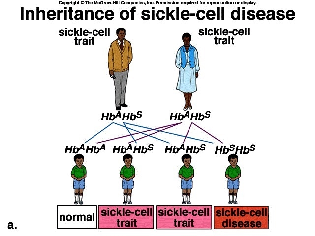 What is required for a person to have sickle-cell disease? A. the person is homozygous-example-1