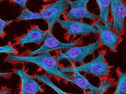 The hela s3 cancer cell line is considered to be "continuous" due to acquired-example-1