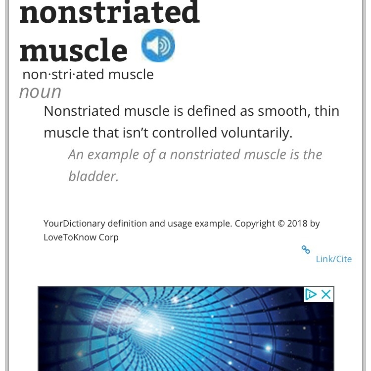 The only kind of muscle tissue that does not have striations is-example-1