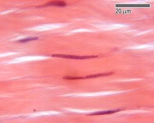 Name the connective tissue that looks like strands of wavy hair that contains parallel-example-1