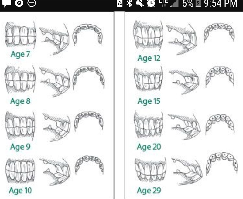 True or false looking at the teeth of a horse can help determine the animal's age-example-1