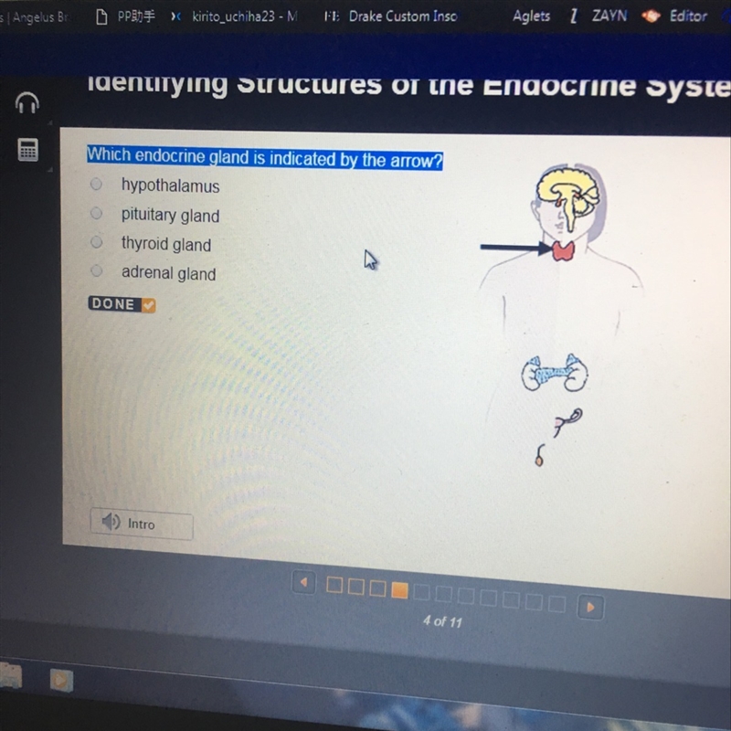 Which endocrine gland is indicated by the arrow?-example-1