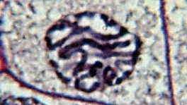 The microscope image here shows that the chromosomes are condensed. Which cellular-example-1