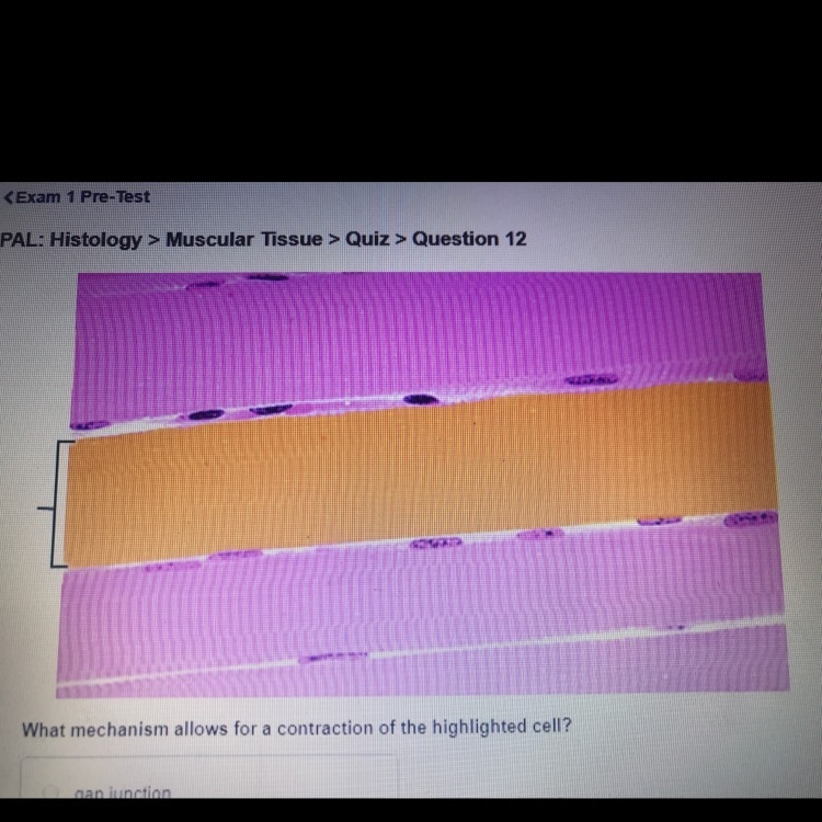 What mechanism allows for a contraction of the highlighted cell? -gap junction -tight-example-1