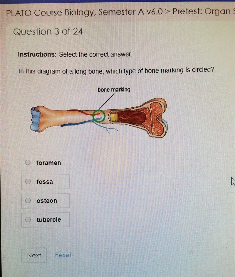 In this diagram of a long bone, which type of bone marking is circled?-example-1