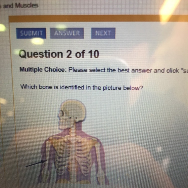 Which bone is identified in the picture below-example-1