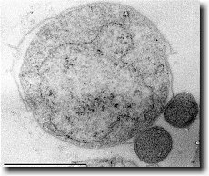 What is the least complex orginsm in the ocean-example-1