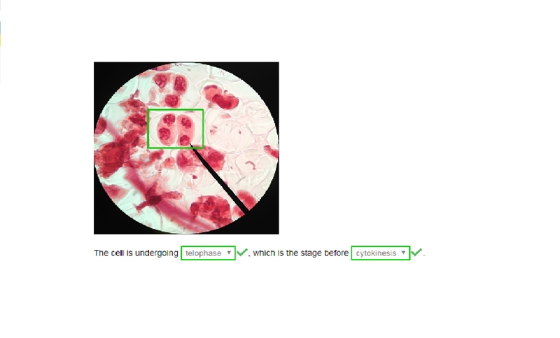 Which phase or mitotic division is the highlighted cell undergoing-example-1