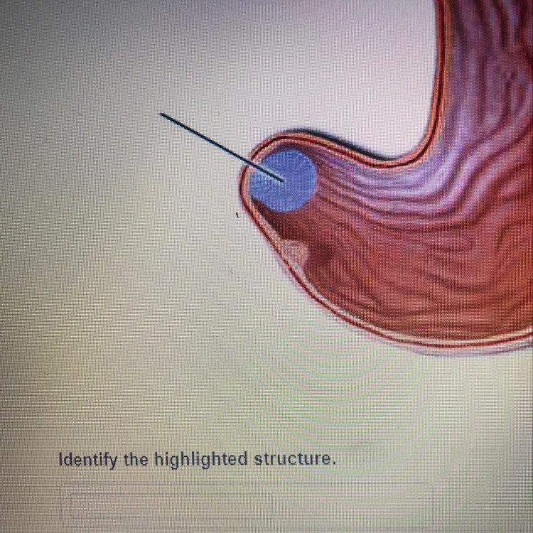 This is the kidney, but what is the structure?-example-1