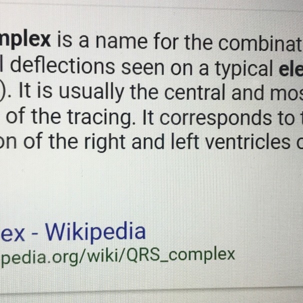 What is the definition of complex in ekg-example-1