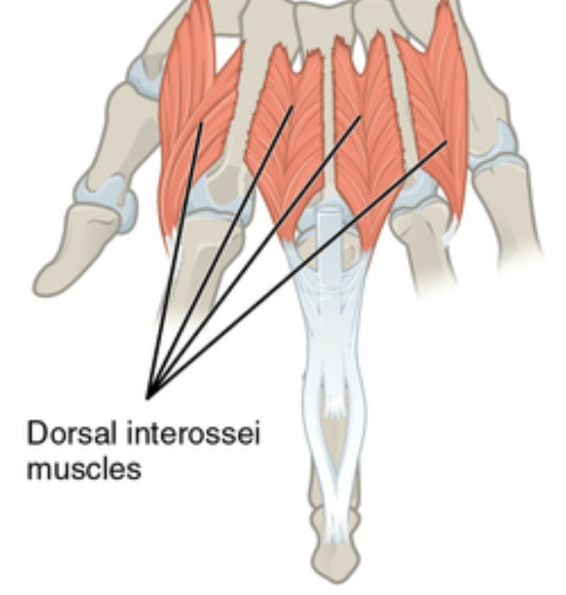 Identify the planar muscle that abducts the fingers from the middle-example-1