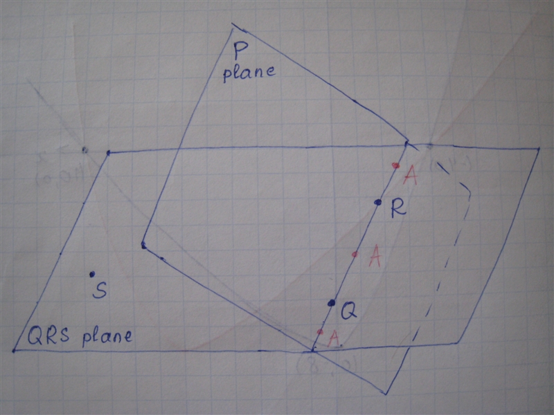 Plane P and plane QRS intersect at QR. points A, Q and R are collinear. How can I-example-1