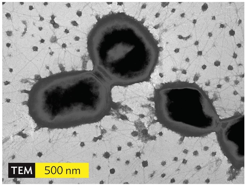 Consider the following image of Porphyromonas gingivalis viewed using transmission-example-1