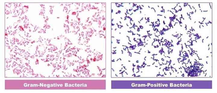 Is the Gram stain a useful tool for understanding the phylogeny of eubacteria? Explain-example-1