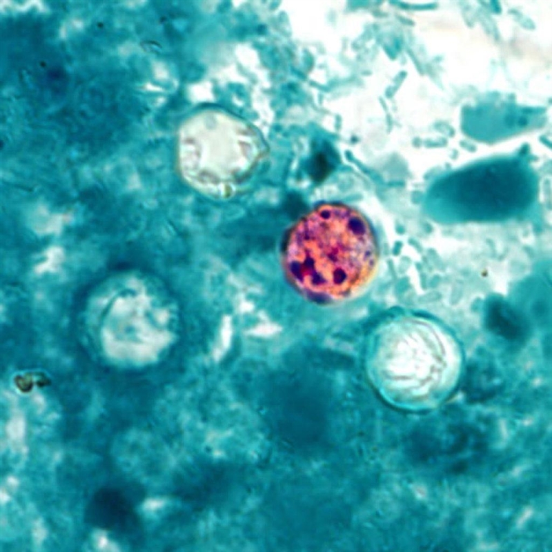 Which protozoan has a unique appearance, with a blue halo, when viewed using ultraviolet-example-1