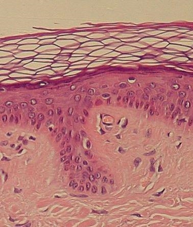 Helppp!!!! What type of tissue is this ??? Nervous tissue, muscle tissue, connective-example-1