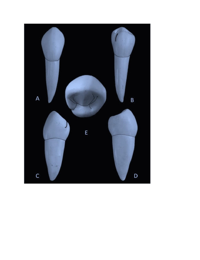 The roots of mandibular first premolars are? A. (flattened faciolingually) and (frequently-example-1