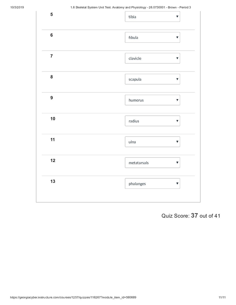 The atlas is classified as a(n) ___ vertebrae. Group of answer choices cervical sacral-example-3