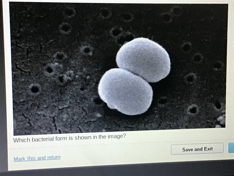 Consider this microscopic image of bacteria. Spherical bacteria is shown. Which type-example-1