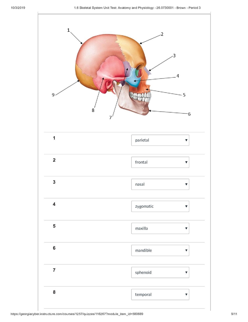 The atlas is classified as a(n) ___ vertebrae. Group of answer choices cervical sacral-example-1