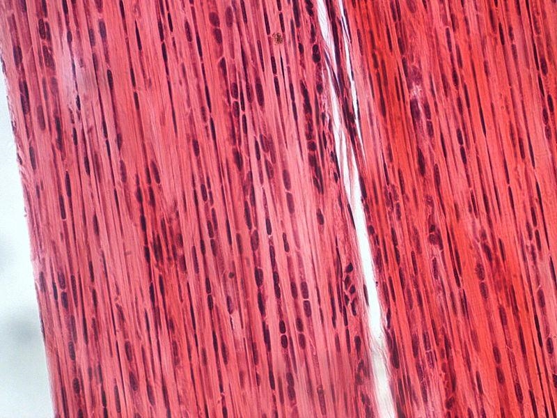 Provides great strength through parallel bundles of collagenic fibers found in tendons-example-1