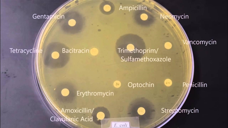 In the Kirby-Bauer Antimicrobial Susceptibility Test, which of the following labels-example-1