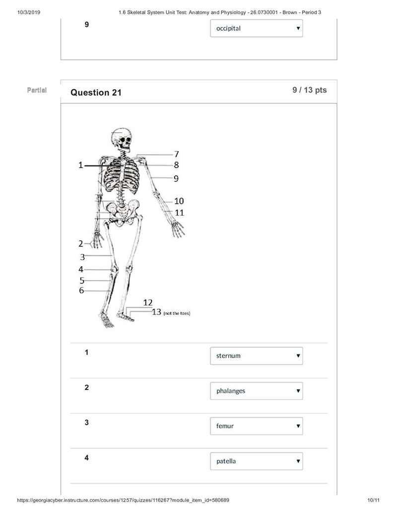 The atlas is classified as a(n) ___ vertebrae. Group of answer choices cervical sacral-example-2