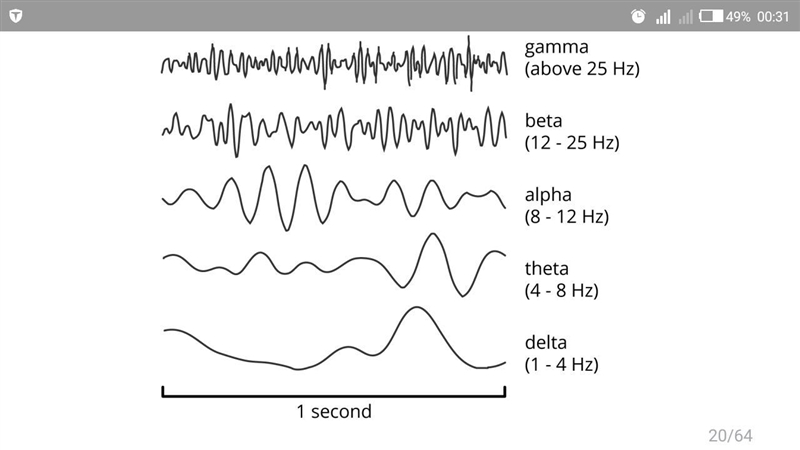 Your brain waves are being monitored in a sleep laboratory. If you are in deep sleep-example-1