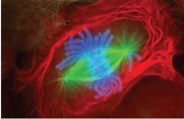 The cell below is a lung cell of a salamander. In which stage of mitosis is it? What-example-1