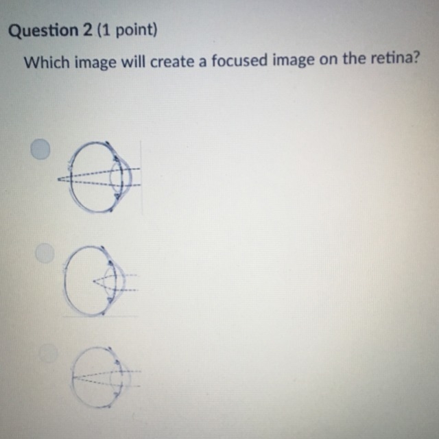 Which image will create a focused image on the retina?-example-1