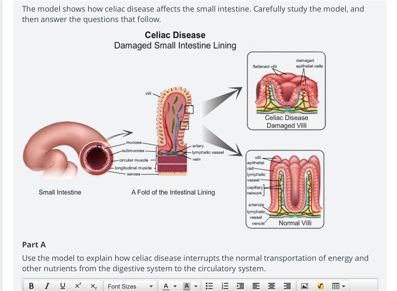 Use the model to explain how celiac disease interrupts the normal transportation of-example-1